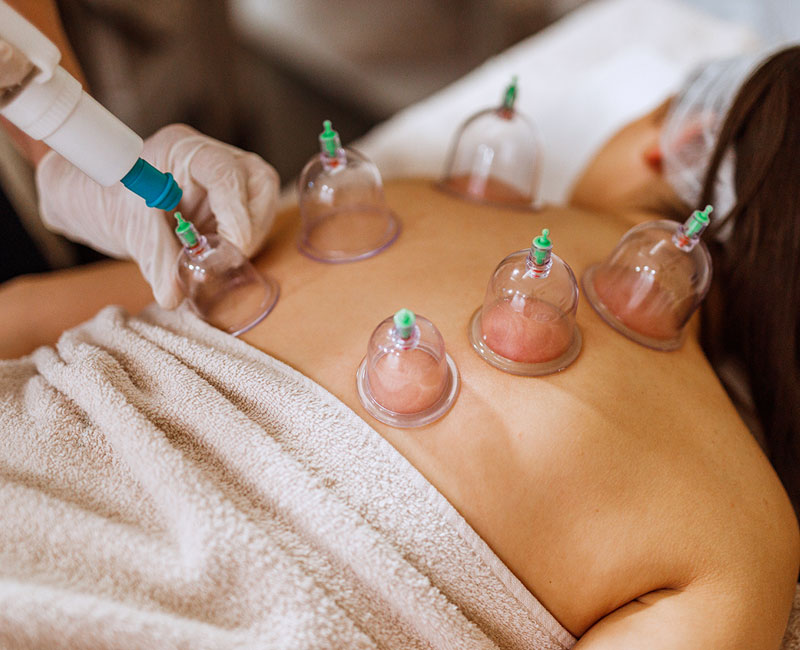 NON Abrasive - cupping Therapy